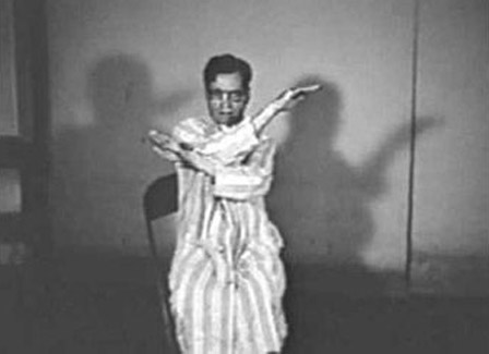 اختلال کاتاتونی مرتبط با اختلال روانی دیگر در DSM-5