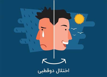 اختلال دوقطبی نوع II در DSM-5